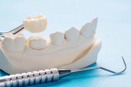 Dental Crowns above of the Page