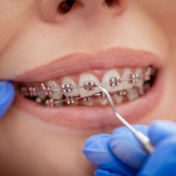 Orthodontics above of the Page